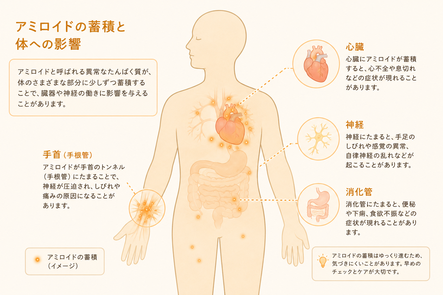 アミロイドが全身に蓄積するイメージ