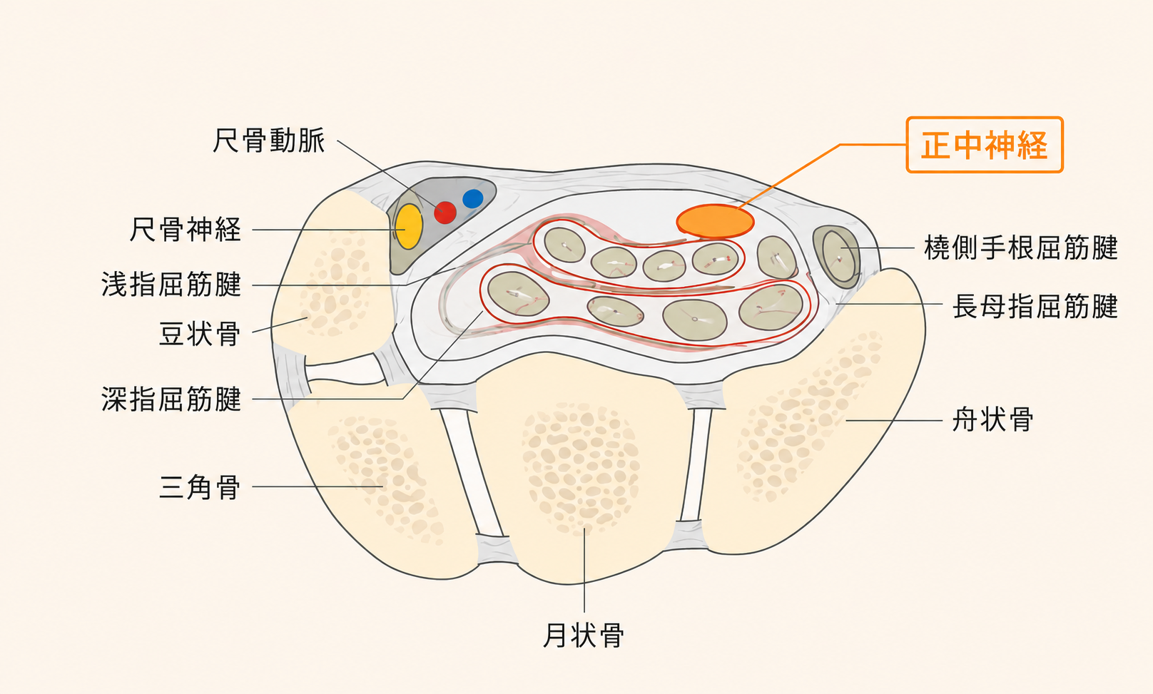 手根管症候群のしくみ図