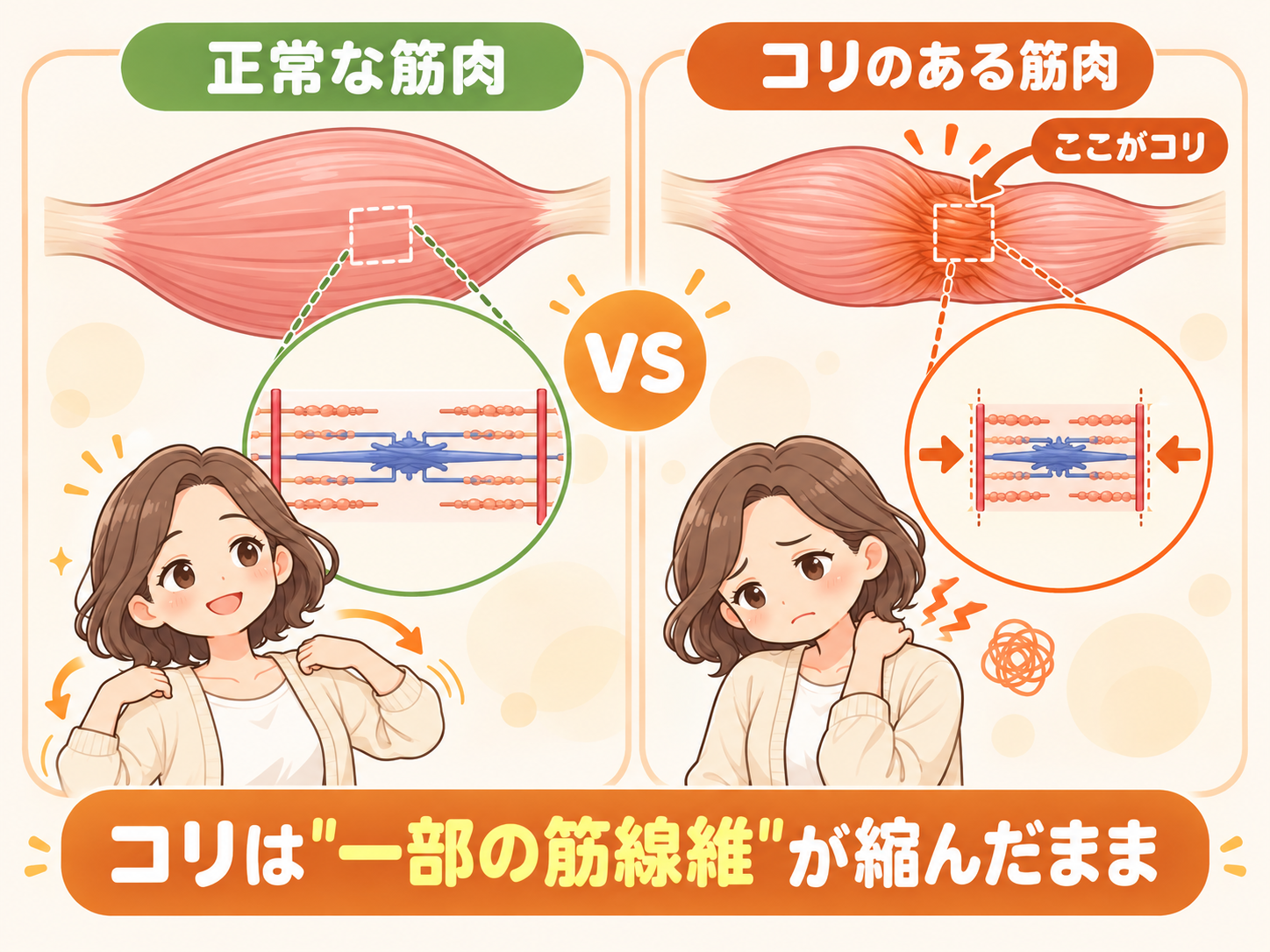 コリのある筋肉と正常な筋肉の違いを比べたイラスト